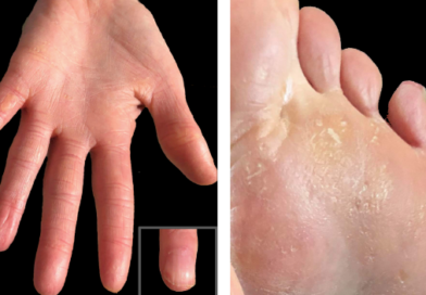 আর্দ্রতা ধরে রাখতে সাহায্য করে। টোম্যাটোর অসাধারন ৮ টি কার্যকারিতা